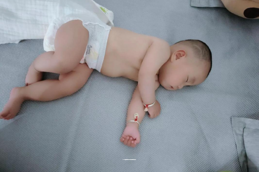 庄河六个月宝宝眼睛散光
